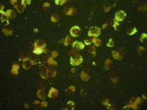 Rickettsia r. - 400x