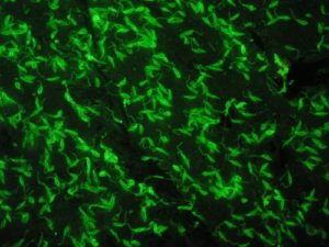 Leishmania infantum - 400x