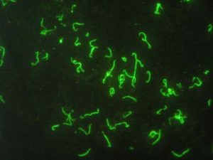 Leptospira spp. - 400x