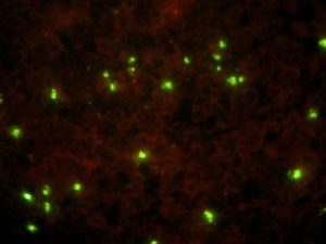 Babesia equi - 1000x