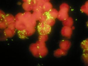 Rickettsia r. - 1000x