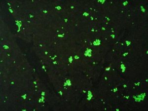 Babesia canis - 400x