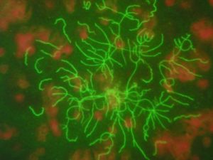 Borrelia b. - 1000x