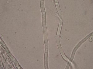 Ife fungine settate (Urine, cane)