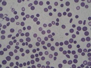 Emobartonella (Gatto)