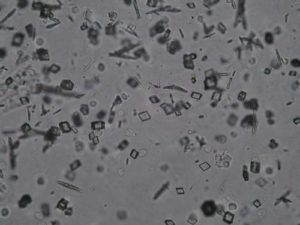 Acido urico - 400x