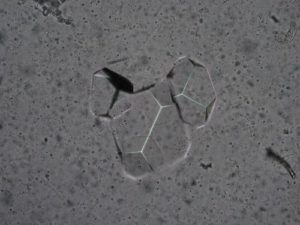 Fosfati tripli (Struvite) - 1000x